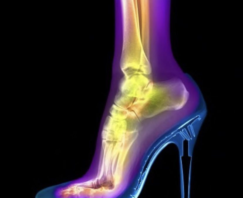 Love heels? I do too, but this is what it does to your body..